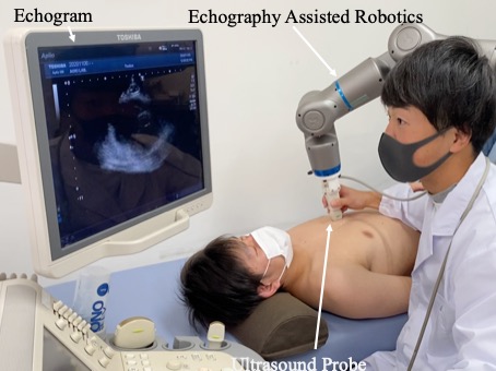 ベッドの上に横たわった人の胸元にロボットを当てて、モニターのエコーを確認する様子