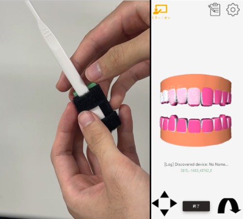 ▲Properio AIのアタッチメントと、アプリ上の画面。ピンク色の濃さで磨き残しの程度を表しています。